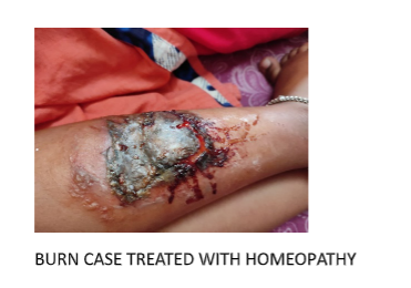 Before Treatment